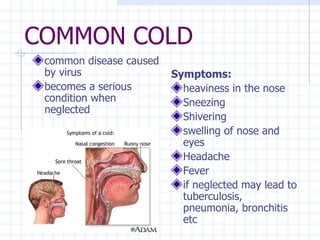 COMMON COLD common disease caused by virus becomes a serious condition when neglected   Symptoms: heaviness in the nose Sneezing Shivering swelling of nose and eyes Headache Fever if neglected may lead to tuberculosis, pneumonia, bronchitis etc   