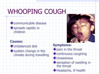 WHOOPING COUGH communicable disease spreads rapidly in children Causes: Unbalanced diet sudden change in the climate during travelling Symptoms: pain in the throat continuous coughing Uneasiness sensation of swelling in the throat Headache, ill health   