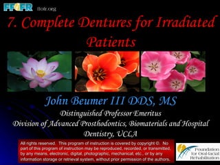 7. Complete Dentures for Irradiated
             Patients


               John Beumer III DDS, MS
                Distinguished Professor Emeritus
 Division of Advanced Prosthodontics, Biomaterials and Hospital
                       Dentistry, UCLA
   All rights reserved. This program of instruction is covered by copyright ©. No
   part of this program of instruction may be reproduced, recorded, or transmitted,
   by any means, electronic, digital, photographic, mechanical, etc., or by any
   information storage or retrieval system, without prior permission of the authors.
 