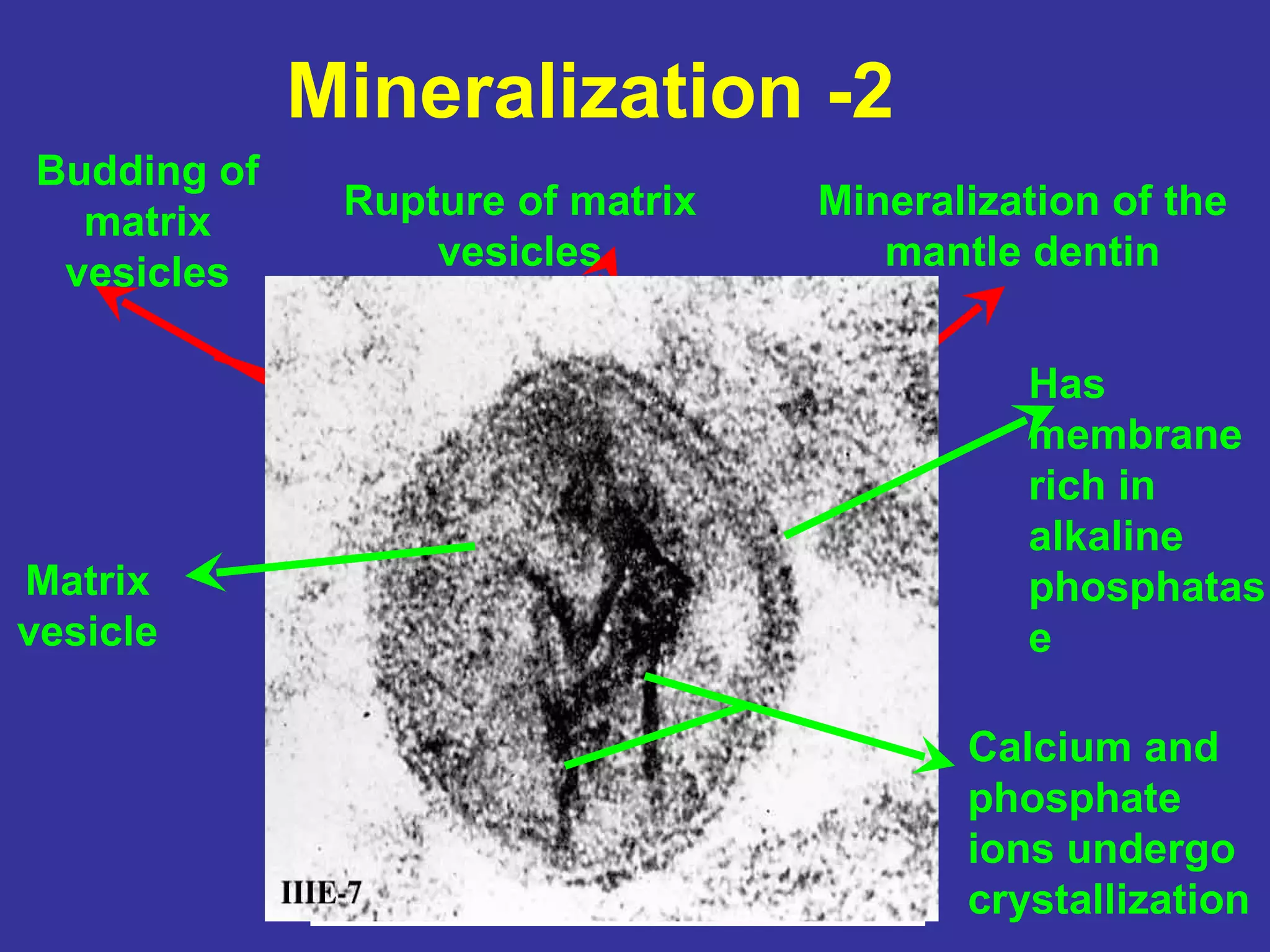 Mineralization -2
Budding of
  matrix      Rupture of matrix   Mineralization of the
 vesicles         vesicles           mantle dentin


                                            Has
                                            membrane
                                            rich in
                                            alkaline
Matrix                                      phosphatas
vesicle                                     e

                                         Calcium and
                                         phosphate
                                         ions undergo
                                         crystallization
 