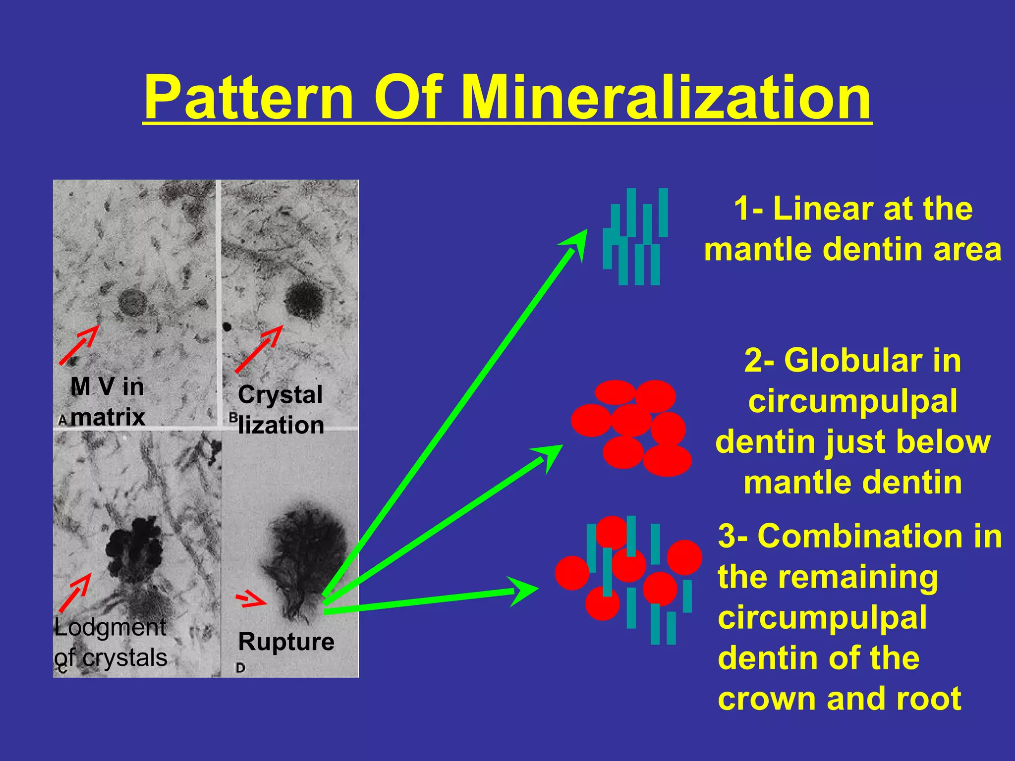 Pattern Of Mineralization
                            1- Linear at the
                           mantle dentin area


                            2- Globular in
 M V in       Crystal
 matrix
                             circumpulpal
              lization
                           dentin just below
                            mantle dentin
                           3- Combination in
                           the remaining
Lodgment                   circumpulpal
              Rupture
of crystals                dentin of the
                           crown and root
 