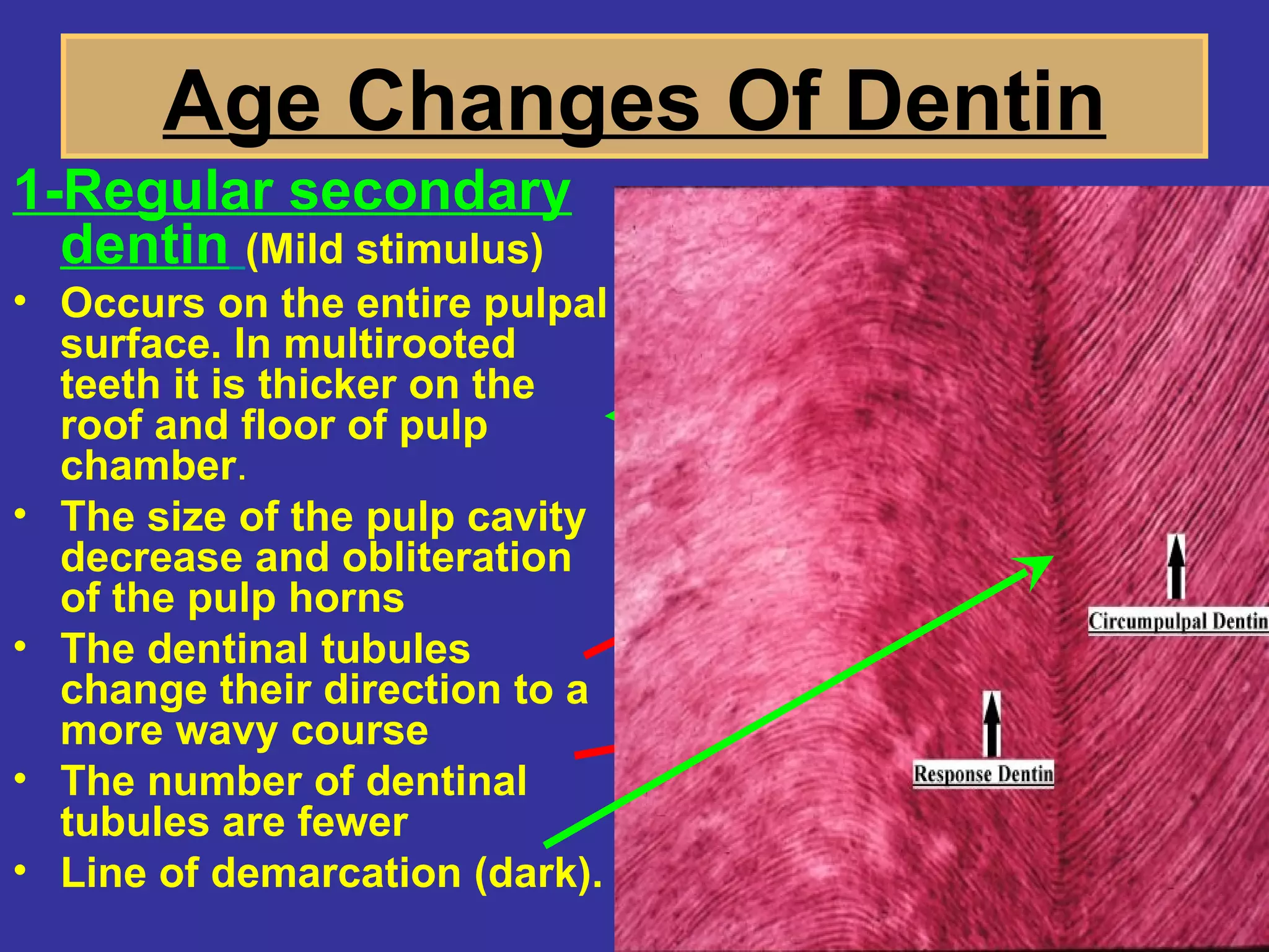 Age Changes Of Dentin
1-Regular secondary
  dentin (Mild stimulus)
• Occurs on the entire pulpal
  surface. In multirooted
  teeth it is thicker on the
  roof and floor of pulp
  chamber.
• The size of the pulp cavity
  decrease and obliteration
  of the pulp horns
• The dentinal tubules
  change their direction to a
  more wavy course
• The number of dentinal
  tubules are fewer
• Line of demarcation (dark).
 