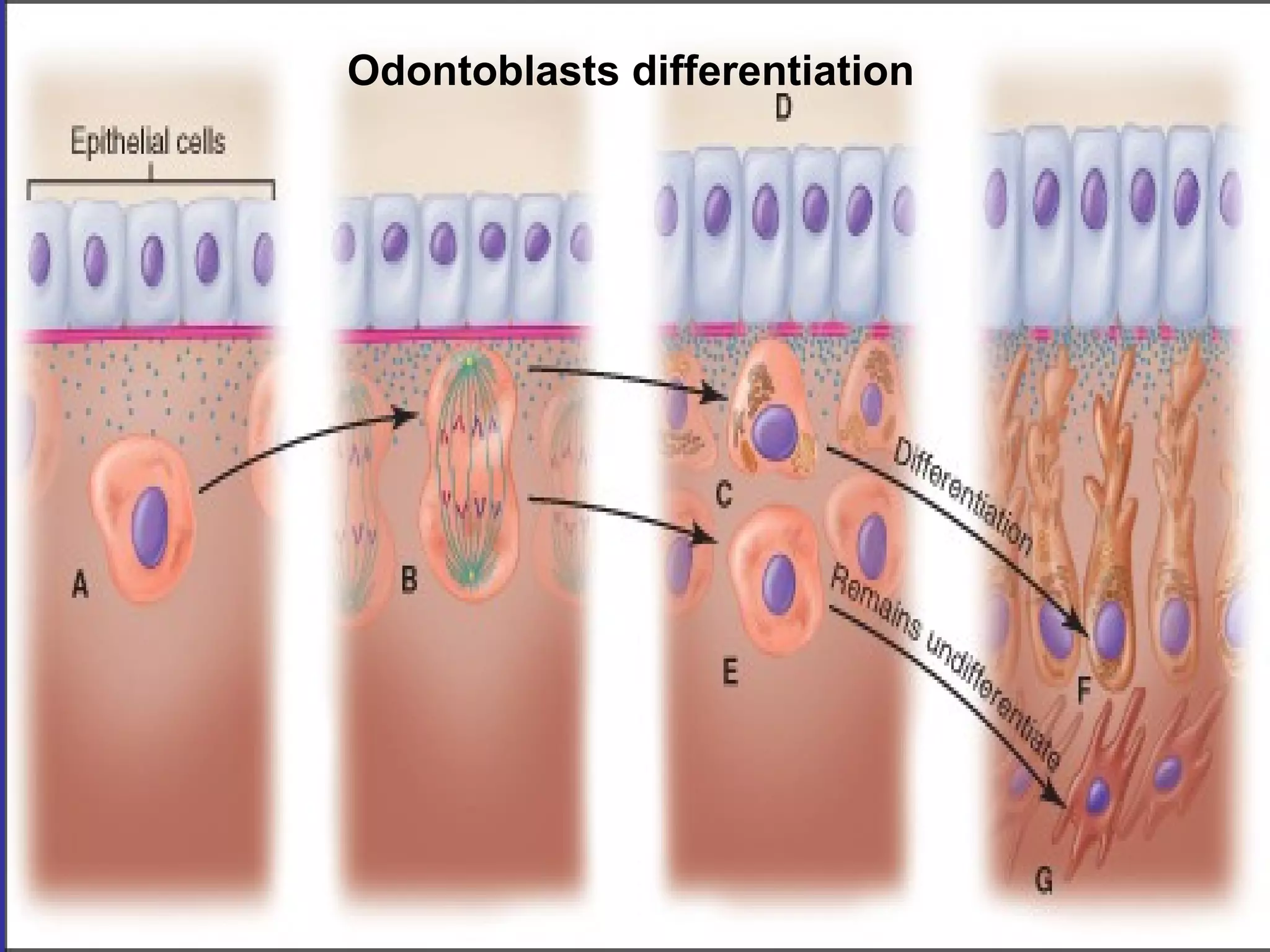 Odontoblasts differentiation
 