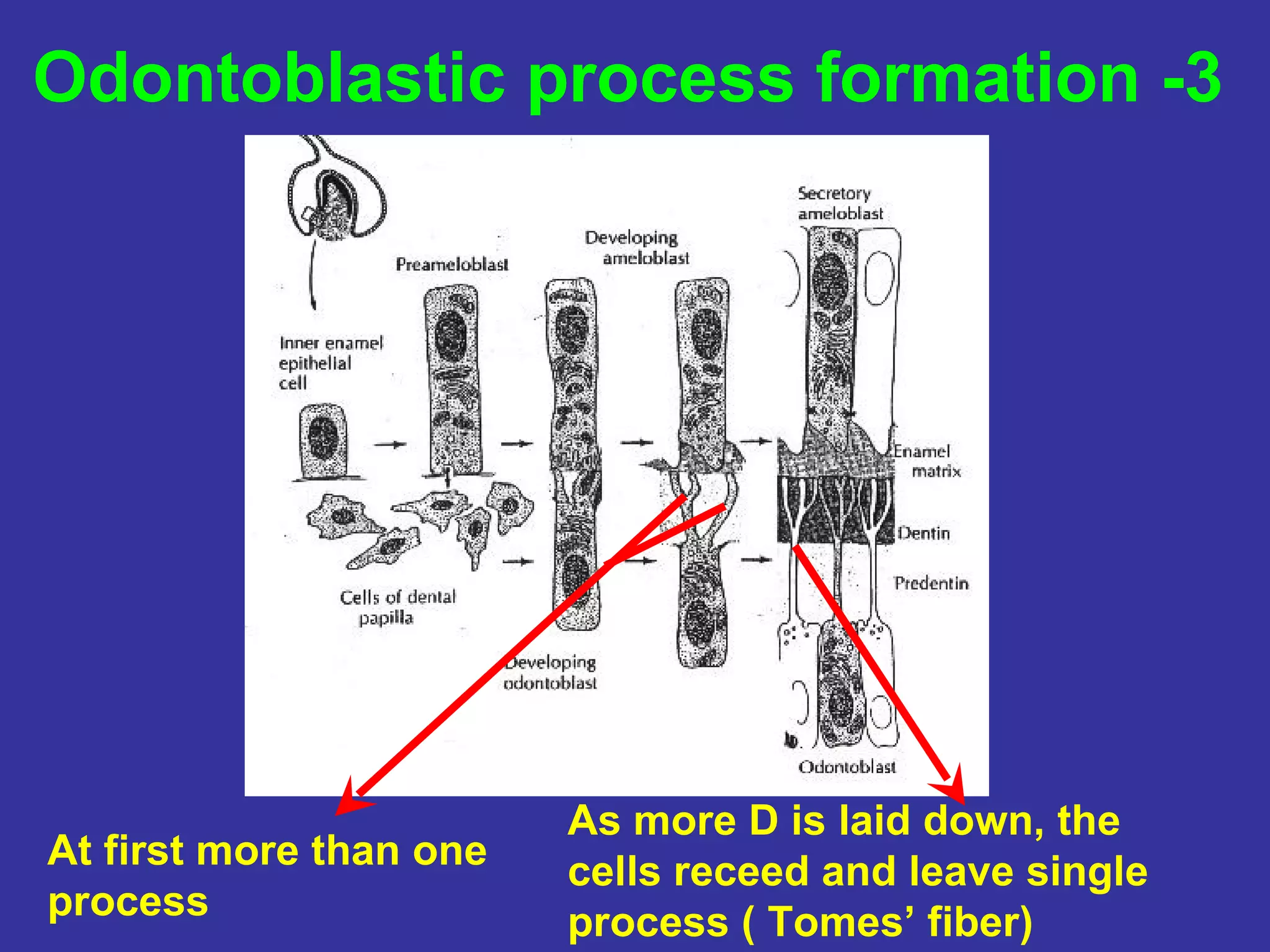 Odontoblastic process formation -3




                         As more D is laid down, the
At first more than one   cells receed and leave single
process                  process ( Tomes’ fiber)
 