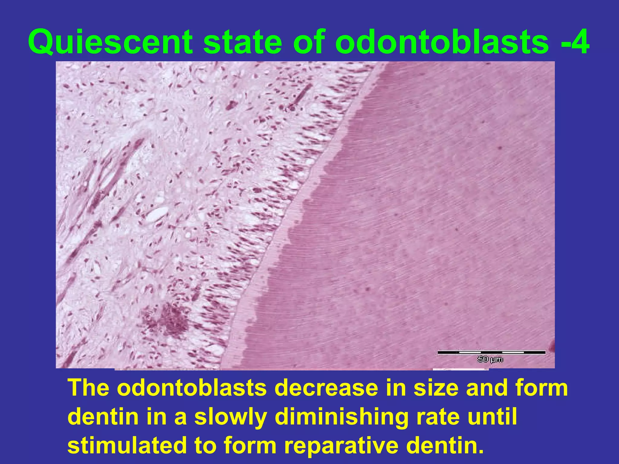 Quiescent state of odontoblasts -4




  The odontoblasts decrease in size and form
  dentin in a slowly diminishing rate until
  stimulated to form reparative dentin.
 