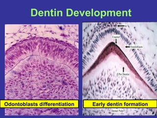 7 dentinogenesis | PPT | Dental Health | Diseases and Conditions