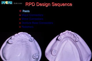 RPD Design Sequence
v  Rests
v  Major Connectors
v  Minor Connectors
v  Denture Base Connectors
v  Retainers
 