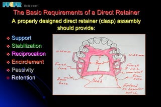 The Basic Requirements of a Direct Retainer
  A properly designed direct retainer (clasp) assembly
                    should provide:
v  Support
v  Stabilization
v  Reciprocation
v  Encirclement
v  Passivity
v  Retention
 