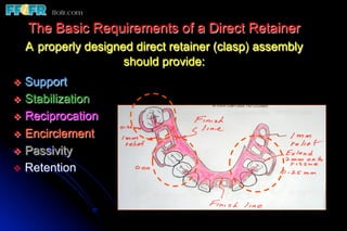 The Basic Requirements of a Direct Retainer
  A properly designed direct retainer (clasp) assembly
                    should provide:
v  Support
v  Stabilization
v  Reciprocation
v  Encirclement
v  Passivity
v  Retention
 