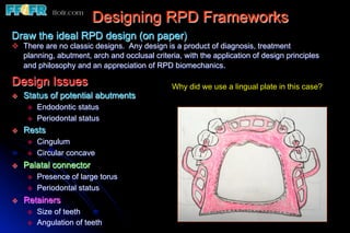 Designing RPD Frameworks
Draw the ideal RPD design (on paper)
v  There are no classic designs. Any design is a product of diagnosis, treatment
    planning, abutment, arch and occlusal criteria, with the application of design principles
    and philosophy and an appreciation of RPD biomechanics.

Design Issues                                   Why did we use a lingual plate in this case?
v    Status of potential abutments
       v    Endodontic status
       v    Periodontal status
v    Rests
       v    Cingulum
       v    Circular concave
v    Palatal connector
       v    Presence of large torus
       v    Periodontal status
v    Retainers
       v    Size of teeth
       v    Angulation of teeth
 
