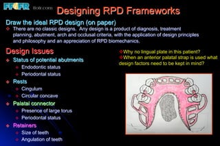 Designing RPD Frameworks
Draw the ideal RPD design (on paper)
v  There are no classic designs. Any design is a product of diagnosis, treatment
    planning, abutment, arch and occlusal criteria, with the application of design principles
    and philosophy and an appreciation of RPD biomechanics.

Design Issues                                         v Why no lingual plate in this patient?
v    Status of potential abutments                   v When an anterior palatal strap is used what
                                                      design factors need to be kept in mind?
       v    Endodontic status
       v    Periodontal status
v    Rests
       v    Cingulum
       v    Circular concave
v    Palatal connector
       v    Presence of large torus
       v    Periodontal status
v    Retainers
       v    Size of teeth
       v    Angulation of teeth
 