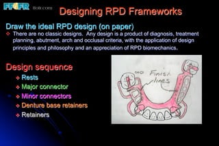 Designing RPD Frameworks
Draw the ideal RPD design (on paper)
v  There are no classic designs. Any design is a product of diagnosis, treatment
    planning, abutment, arch and occlusal criteria, with the application of design
    principles and philosophy and an appreciation of RPD biomechanics.


Design sequence
    v  Rests
    v  Major connector
    v  Minor connectors
    v  Denture base retainers
    v  Retainers
 