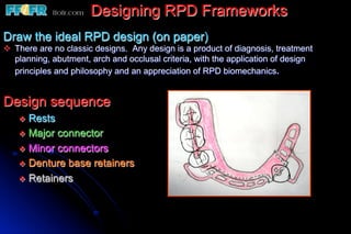 Designing RPD Frameworks
Draw the ideal RPD design (on paper)
v  There are no classic designs. Any design is a product of diagnosis, treatment
    planning, abutment, arch and occlusal criteria, with the application of design
    principles and philosophy and an appreciation of RPD biomechanics.


Design sequence
    v  Rests
    v  Major connector
    v  Minor connectors
    v  Denture base retainers
    v  Retainers
 