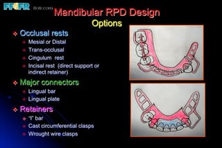 Mandibular RPD Design
                                   Options
v  Occlusal rests
    v  Mesial or Distal
    v  Trans-occlusal
    v  Cingulum rest
    v  Incisal rest (direct support or
        indirect retainer)
v  Major connectors
    v  Lingual bar
    v  Lingual plate

v  Retainers
    v  “I” bar
    v  Cast circumferential clasps
    v  Wrought wire clasps
 
