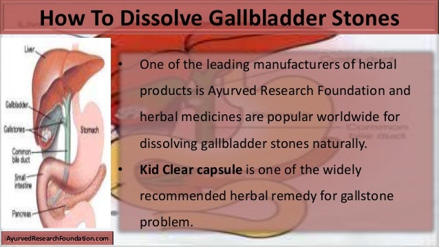 How To Dissolve Gallbladder Stones Naturally How To Dissolve Gallbladder Stones Naturally
