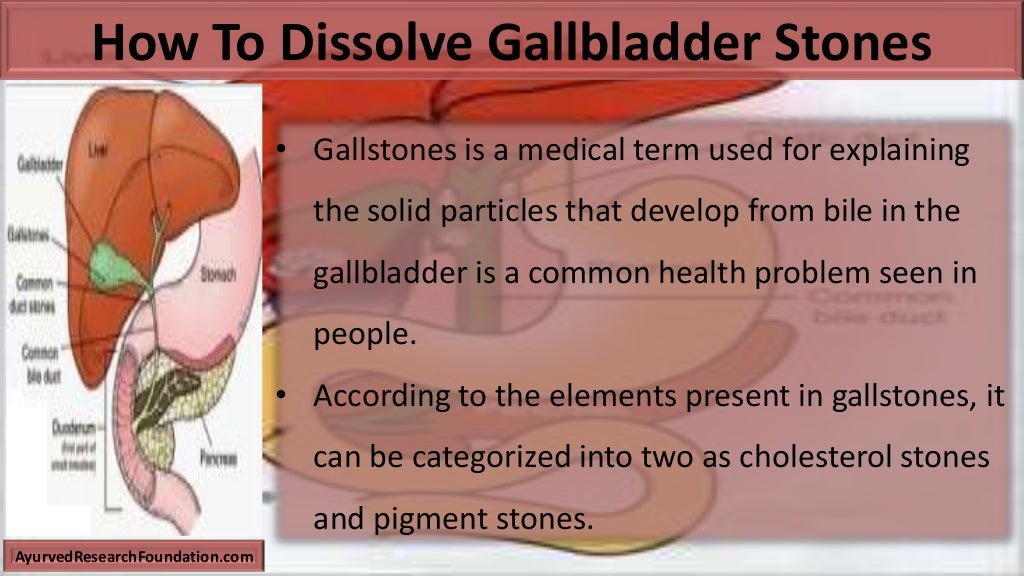 Dissolve Gallbladder Stones Naturally And Safely With Kid Clear Capsu…