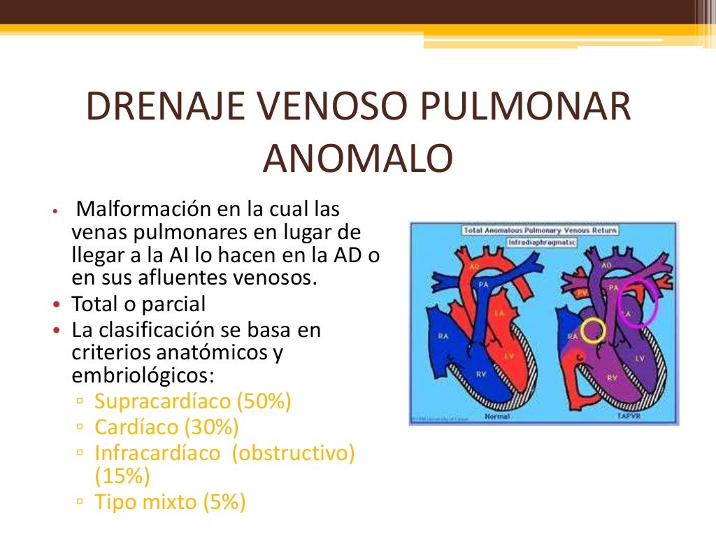 7. drenaje venoso anomalo venas pulmonares