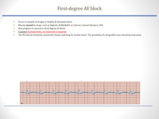 Comprehensive Assessment of Cardiovascular Dysrhythmias and Conduction ...