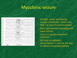 Myoclonic seizure
19
 Sudden, quick, arrhythmic
muscle contraction, twitch of a
limb; no loss of consciousness
 EEG: generalised polyspike and
wave activity
 Occurs in genetic (idiopathic)
epilepsies
 Not only an epileptic
phenomenon- it can be the sign
of diffuse encephalopathies
 