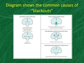 Diagram shows the common causes of
“blackouts”
26
 