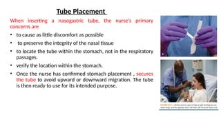 Intestinal Intubation 7- gastrointestinal intubation, nursing management | PPTX