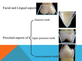 Geometric outline of teeth | PPTX