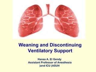 Weaning and Discontinuing
Ventilatory Support
Hanaa A. El Gendy
Assistant Professor of Anesthesia
and ICU (ASUH(
 