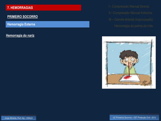 7. HEMORRAGIAS                    I - Compressão Manual Directa
                                    II - Compressão Manual Indirecta
  PRIMEIRO SOCORRO
                                    III – Garrote Arterial (improvisado)
  Hemorragia Externa                    Hemorragia da palma da mão

 Hemorragia do nariz




Jorge Almeida, Prof. Adj. - ESALD      UC Primeiros Socorros – CET Protecção Civil - 2012
 