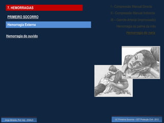 7. HEMORRAGIAS                    I - Compressão Manual Directa
                                    II - Compressão Manual Indirecta
  PRIMEIRO SOCORRO
                                    III – Garrote Arterial (improvisado)
  Hemorragia Externa                    Hemorragia da palma da mão
                                                    Hemorragia do nariz
 Hemorragia do ouvido




Jorge Almeida, Prof. Adj. - ESALD      UC Primeiros Socorros – CET Protecção Civil - 2012
 