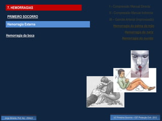 7. HEMORRAGIAS                    I - Compressão Manual Directa
                                    II - Compressão Manual Indirecta
  PRIMEIRO SOCORRO
                                    III – Garrote Arterial (improvisado)
  Hemorragia Externa                   Hemorragia da palma da mão
                                                    Hemorragia do nariz
 Hemorragia da boca
                                                Hemorragia do ouvido




Jorge Almeida, Prof. Adj. - ESALD      UC Primeiros Socorros – CET Protecção Civil - 2012
 