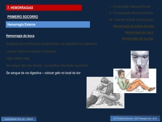 7. HEMORRAGIAS                                                           I - Compressão Manual Directa
                                                                           II - Compressão Manual Indirecta
  PRIMEIRO SOCORRO
                                                                           III – Garrote Arterial (improvisado)
  Hemorragia Externa                                                          Hemorragia da palma da mão
                                                                                           Hemorragia do nariz
 Hemorragia da boca
                                                                                       Hemorragia do ouvido
 Averiguar proveniência do sangue (local, via respiratória ou digestiva)

 Colocar vítima em posição confortável
 Vigiar sinais vitais
 Se sangue das vias aéreas – aconselhar respiração superficial

 Se sangue da via digestiva – colocar gelo no local da dor




Jorge Almeida, Prof. Adj. - ESALD                                             UC Primeiros Socorros – CET Protecção Civil - 2012
 