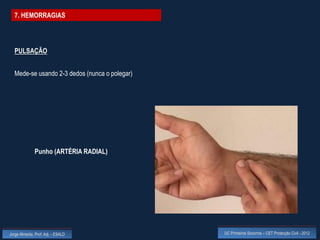 7. HEMORRAGIAS




  PULSAÇÃO


  Mede-se usando 2-3 dedos (nunca o polegar)




              Punho (ARTÉRIA RADIAL)




Jorge Almeida, Prof. Adj. - ESALD              UC Primeiros Socorros – CET Protecção Civil - 2012
 