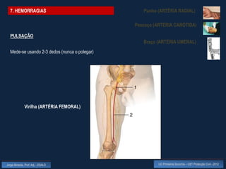 7. HEMORRAGIAS                                  Punho (ARTÉRIA RADIAL)

                                               Pescoço (ARTÉRIA CARÓTIDA)

  PULSAÇÃO
                                                  Braço (ARTÉRIA UMERAL)
  Mede-se usando 2-3 dedos (nunca o polegar)




              Virilha (ARTÉRIA FEMORAL)




Jorge Almeida, Prof. Adj. - ESALD                        UC Primeiros Socorros – CET Protecção Civil - 2012
 