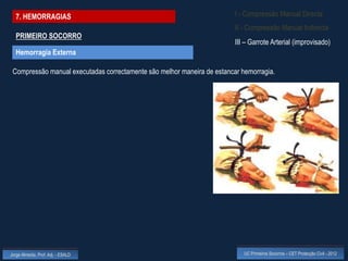7. HEMORRAGIAS                                                         I - Compressão Manual Directa
                                                                         II - Compressão Manual Indirecta
  PRIMEIRO SOCORRO
                                                                         III – Garrote Arterial (improvisado)
  Hemorragia Externa

 Compressão manual executadas correctamente são melhor maneira de estancar hemorragia.




Jorge Almeida, Prof. Adj. - ESALD                                           UC Primeiros Socorros – CET Protecção Civil - 2012
 