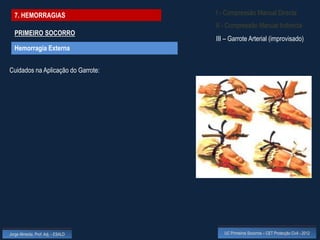 7. HEMORRAGIAS                    I - Compressão Manual Directa
                                    II - Compressão Manual Indirecta
  PRIMEIRO SOCORRO
                                    III – Garrote Arterial (improvisado)
  Hemorragia Externa


Cuidados na Aplicação do Garrote:




Jorge Almeida, Prof. Adj. - ESALD      UC Primeiros Socorros – CET Protecção Civil - 2012
 