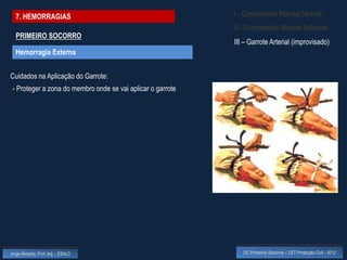 7. HEMORRAGIAS                                             I - Compressão Manual Directa
                                                             II - Compressão Manual Indirecta
  PRIMEIRO SOCORRO
                                                             III – Garrote Arterial (improvisado)
  Hemorragia Externa


Cuidados na Aplicação do Garrote:
 - Proteger a zona do membro onde se vai aplicar o garrote




Jorge Almeida, Prof. Adj. - ESALD                               UC Primeiros Socorros – CET Protecção Civil - 2012
 