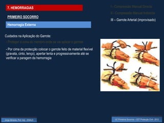 7. HEMORRAGIAS                                                        I - Compressão Manual Directa
                                                                        II - Compressão Manual Indirecta
  PRIMEIRO SOCORRO
                                                                        III – Garrote Arterial (improvisado)
  Hemorragia Externa


Cuidados na Aplicação do Garrote:
 - Proteger a zona do membro onde se vai aplicar o garrote

 - Por cima da protecção colocar o garrote feito de material flexível
 (gravata, cinto, lenço), apertar lenta e progressivamente até se
 verificar a paragem da hemorragia




Jorge Almeida, Prof. Adj. - ESALD                                          UC Primeiros Socorros – CET Protecção Civil - 2012
 