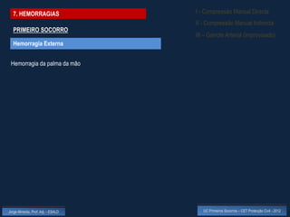 7. HEMORRAGIAS                    I - Compressão Manual Directa
                                    II - Compressão Manual Indirecta
  PRIMEIRO SOCORRO
                                    III – Garrote Arterial (improvisado)
  Hemorragia Externa


 Hemorragia da palma da mão




Jorge Almeida, Prof. Adj. - ESALD      UC Primeiros Socorros – CET Protecção Civil - 2012
 