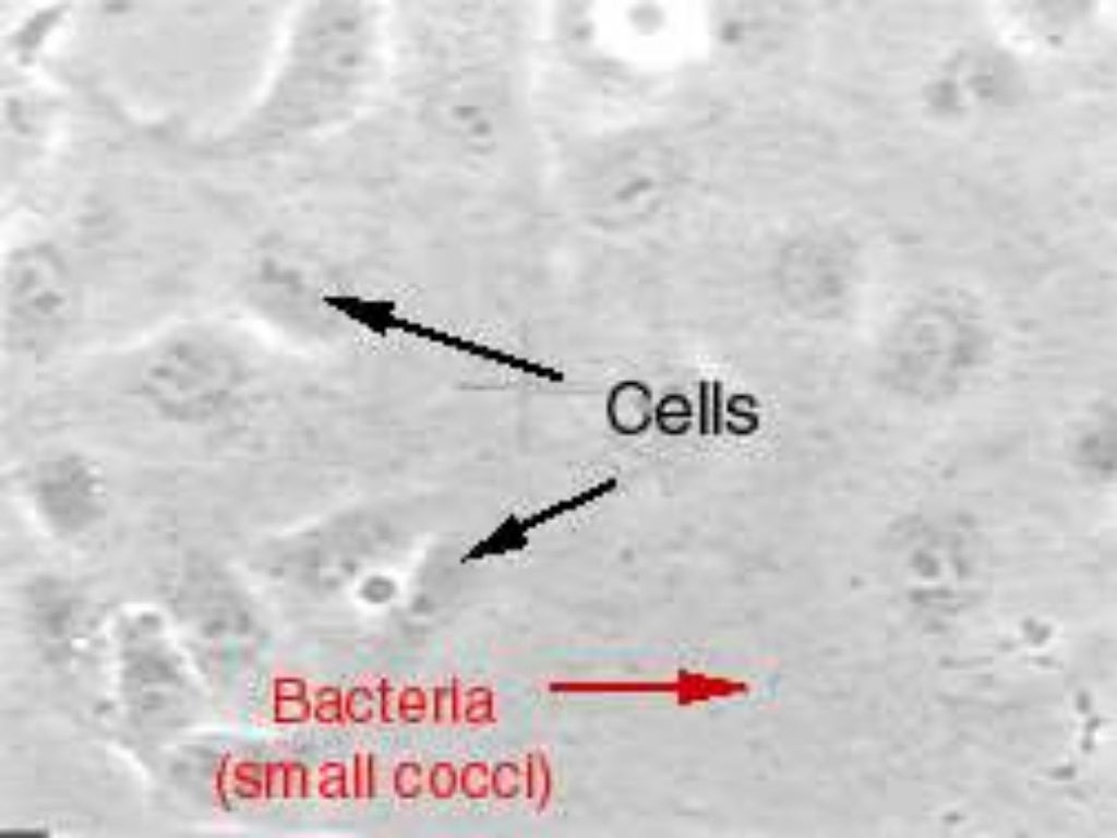 identifying cell culture problems lecture 7