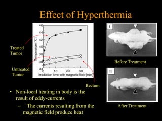 Effect of Hyperthermia


Treated
Tumor
                                         Before Treatment
Untreated
Tumor

                                Rectum
• Non-local heating in body is the
  result of eddy-currents
   – The currents resulting from the      After Treatment
     magnetic field produce heat
 
