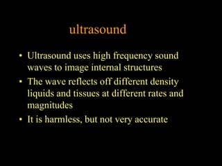 ultrasound
• Ultrasound uses high frequency sound
  waves to image internal structures
• The wave reflects off different density
  liquids and tissues at different rates and
  magnitudes
• It is harmless, but not very accurate
 