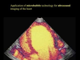 Application of microbubble technology for ultrasound
imaging of the heart
 