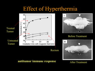Effect of Hyperthermia

Treated
Tumor
Before Treatment
Untreated
Tumor
Rectum

antitumor immune response

After Treatment

 
