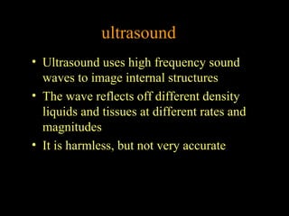 ultrasound
• Ultrasound uses high frequency sound
waves to image internal structures
• The wave reflects off different density
liquids and tissues at different rates and
magnitudes
• It is harmless, but not very accurate

 