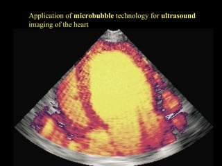 Application of microbubble technology for ultrasound
imaging of the heart

 