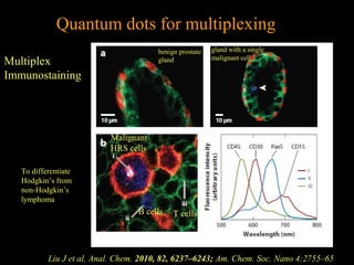 Quantum dots for multiplexing
benign prostate
gland

Multiplex
Immunostaining

gland with a single
malignant cell

Malignant
HRS cells
To differentiate
Hodgkin’s from
non-Hodgkin’s
lymphoma

B cells

T cells

Liu J et al. Anal. Chem. 2010, 82, 6237–6243; Am. Chem. Soc. Nano 4:2755–65

 
