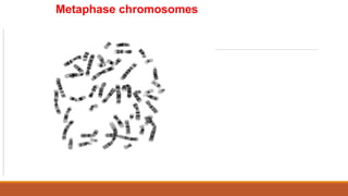 Metaphase chromosomes
 