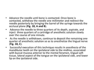 • Advance the needle until bone is contacted. Once bone is
contacted, withdraw the needle one millimeter and redirect the
...