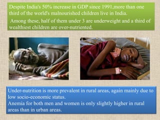 Despite India's 50% increase in GDP since 1991,more than one
third of the world's malnourished children live in India.
Among these, half of them under 3 are underweight and a third of
wealthiest children are over-nutriented.
Under-nutrition is more prevalent in rural areas, again mainly due to
low socio-economic status.
Anemia for both men and women is only slightly higher in rural
areas than in urban areas.
 