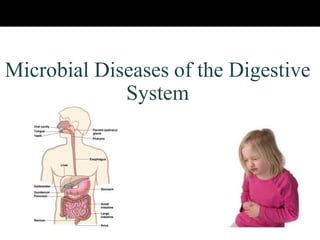 Microbial Diseases of the Digestive
System
 